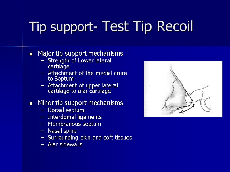Tip support- Test Tip Recoil Major tip support mechanisms Strength of Lower lateral cartilage